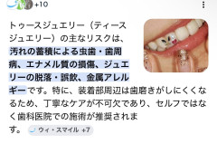 【画像】歯ジュエリー、本格的に流行る