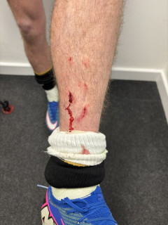 ◆悲報◆ボンマスMFデイビッド・ブルックス、田中碧に膝をスパイクされてゲキオコ！画像UPして「なぜファールじゃないのか理解できない」