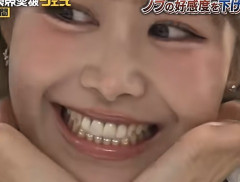 【画像】歯ジュエリー、本格的に流行る