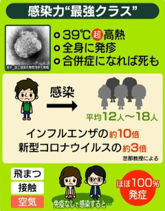 はしか大流行。お前らの想像の数十倍は流行