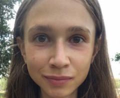 果物だけしか食べない生活をしていた美人インフルエンサーさん、体重22kgの栄養失調で死亡