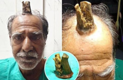 【衝撃】インドのおじさん、ガチで角が生えるｗｗｗｗｗｗｗｗｗｗ