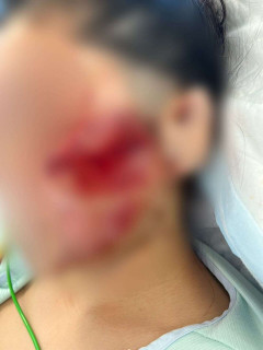 「地獄に突き落とされた感覚。こんな傷だらけになってしまって…」美容が好きだった20代女性　飲酒運転で二度と戻らなくなった顔と身体　念願の留学も白紙に…