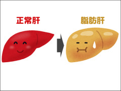 【悩み】脂肪肝を治すためにダイエットしろって言われたけどキツい……