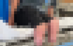 【闇深】自分の両足を切断した外科医、保険金8500万円を騙し取っていたと判明し闇が深すぎる…