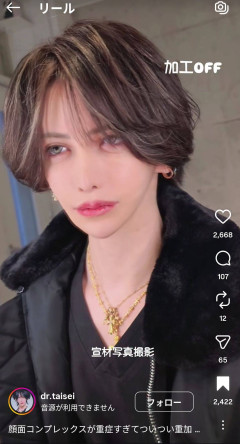 美容外科医さん、理想の小顔を追求し顔面整形に総額5000万円