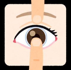 コンタクトをやめたい