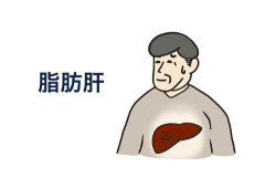 ワイ、脂肪肝と診断され焦ってジムに通うｗｗ
