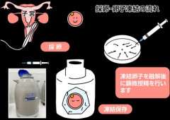 【悲報】未婚女性の「卵子凍結」補助、35歳までに制限 36歳からは対象外へ