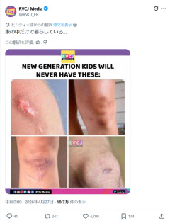【画像】体に「コレ」が無いヤツ、ガチでチー牛確定ｗｗｗｗ