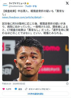 【朗報】中谷潤人さん、眼窩底骨折の疑いもCT検査で「異常なし」だった