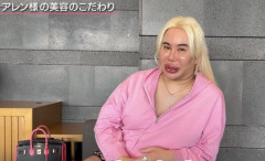 【悲報】整形に1億円以上費やしたアレン様、月150万かけて「今の顔をキープしないと」ｗｗｗｗｗｗｗｗｗｗ
