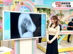 【画像】女子アナさんのレントゲン写真、アレがくっきり写るｗｗｗｗｗｗｗｗｗ