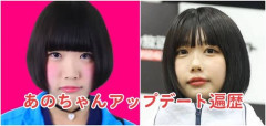 【悲報】あのちゃん、意味深すぎるストーリーを更新してしまうｗｗｗｗｗｗｗｗｗｗ