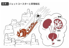 【衝撃】ビッグサンダーマウンテンに乗って尿路結石が出た人続出