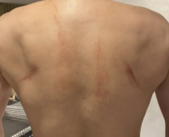 【画像】筋トレ歴6年ワイの背中がガチでエグすぎる