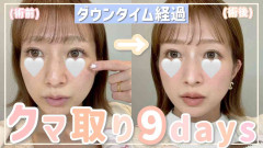 辻希美　美容整形を受けたことを告白　仕上がりに満足「薄くなったんじゃないかな、やってよかった」