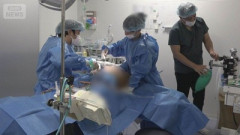 【警告】医師『美容整形の後遺症、恐ろしいことになってる』