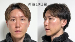 【悲報】男配信者さん、40代に突入した瞬間ガチで別人になってしまうｗｗｗｗｗｗｗｗｗｗ