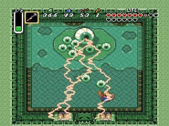 飛蚊症の症状が出て眼医者に行きました