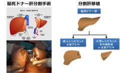 【狂気】人類さん、気づく『遺伝子操作で