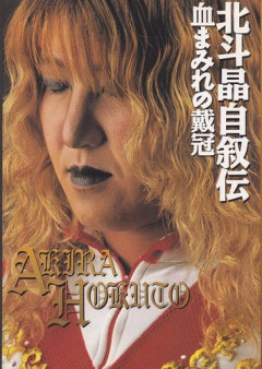 【戦慄】北斗晶さん、帯状疱疹で「もう少し遅れていたら失明していた」・・・・・・・・・