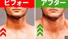お前ら「首」の筋肉をトレーニングしろｗｗｗｗｗ