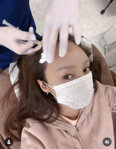 【悲報】神田うのさん、薄毛治療でAGAクリニックに通い始めてしまうwwwwwwwwww