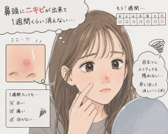鼻頭にニキビが出来て1週間くらい消えない