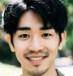 【悲報】髭を永久脱毛した男、後悔し始めるｗｗｗｗｗｗｗｗｗｗｗｗｗｗｗ