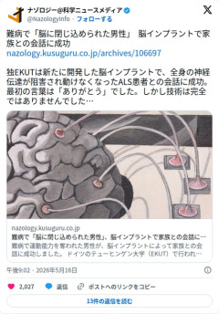 【朗報】脳に閉じ込められたALS患者さん、インプラントで初めて喋った言葉が「ありがとう」