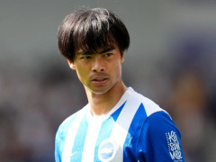 【悲報】三笘さん、ハゲた上にW杯代表から落選してしまう