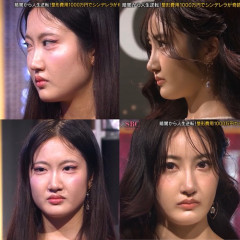 【画像】現役女子大生、1000万円かけて整形した結果ｗｗｗｗ