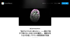 【狂気】人類、気づく「遺伝子操作で『頭のない人体』を量産しまくって臓器取り出せば良いのでは？」