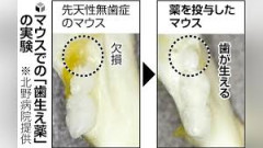 【速報】『歯生え薬』今年の夏、患者に治験開始
