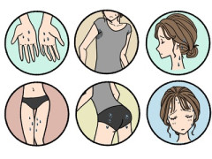 【助けて】全身から汗が吹き出る【全身多汗症】