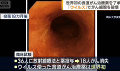 世界初の食道がん治療薬を了承。　「ウイルス」でがん細胞を破壊する治療薬　日本企業が開発　臨床試験では18カ月後には半数にあたる18人のがんが消失（動画あり）　　