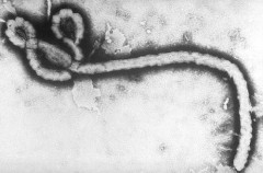 【悲報】エボラウイルス「殺します、殺します、殺します」←こいつが覇権取れなかった理由