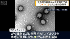 【世界初】日本、世界初の食道がん治療薬了承 ウイルスとガン細胞を戦わせる仕組み「臨床試験で半数にあたる18人の食道ガンが消失」