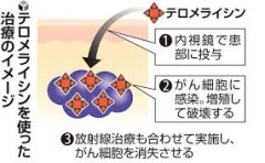 【速報】次世代がん治療法『ガン破壊ウイルス』食道ガン向けに年内販売開始