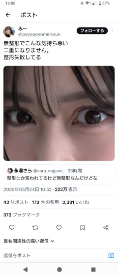 【画像】この目が整形かどうかで意見が分かれる