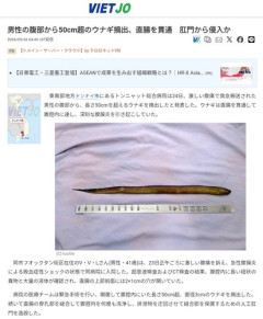 【困惑】腹部から50cm超のウナギが見つかって緊急入院