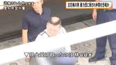 【画像】33才でこんな禿げるものなの？