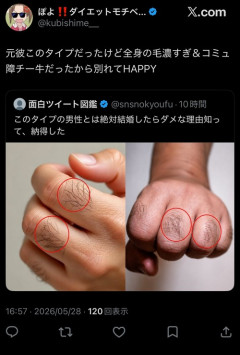 【画像】チー牛特有の「指毛の特徴」、見つかるｗｗｗｗ