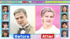 整形芸能人のMattさん　整形手術に失敗して顔面が大変なことになる