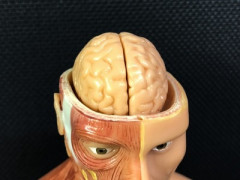 【速報】重度の感染症になった人、その後の人生で認知症になるリスクが高いと判明