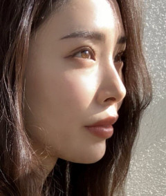 【画像】まんさん、美容整形によって究極のEラインを手に入れるwwwwwwwwww
