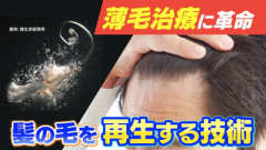 【衝撃】理化学研究所、1本の生き残りから100本生やすことに成功