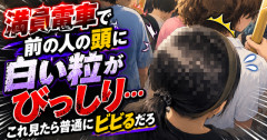 【あかん画像】満員電車で前の人の頭に◯◯◯がびっしり…これ見たら普通にビビるだろ