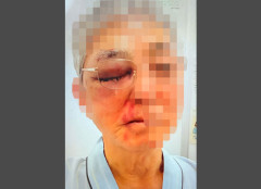 【埼玉・狭山強盗致傷事件】バールで殴られた被害者、顔面公開「めちゃくちゃ痛そう」 17歳の犯人、まさかの逆送なしで少年院の激甘